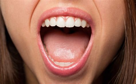 Facts And Tips Dry Mouth