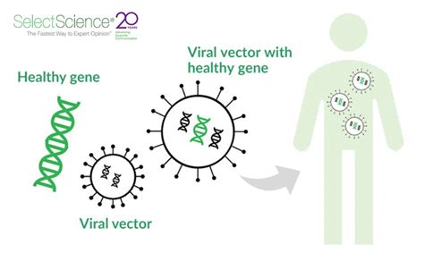 Gene Therapy Is Closer Than We Think A Success Story