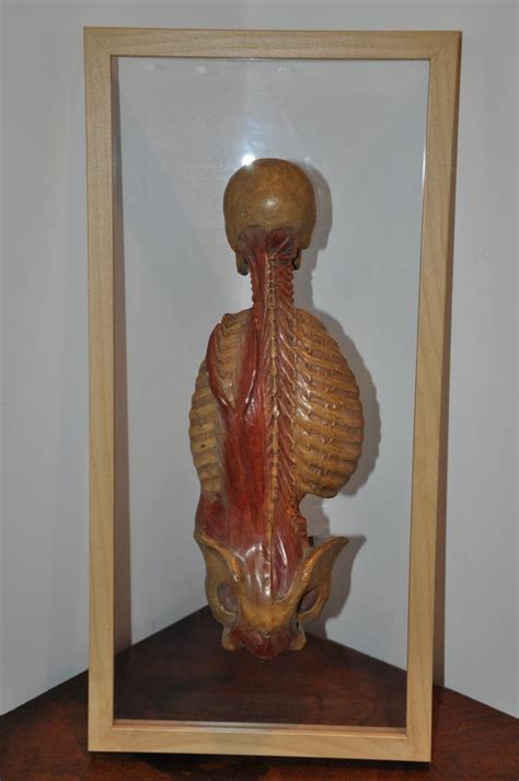 écorché Anatomique Du XIXème Siècle : Dos écorché - objets ...