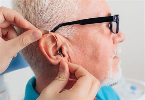 Hearing Aid Technology Levels — An Explanation