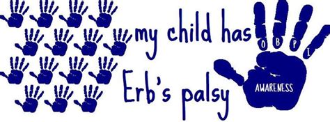 Pin On Birth Injury Awareness Bpi Brachial Plexus Injury Erbs Palsy