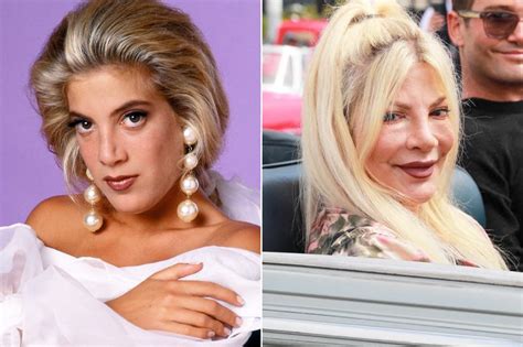 How Plastic Surgery Dramatically Changed These Celebrities Page Of