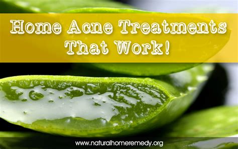 Home Acne Treatments That Work Best All Natural Home Remedies