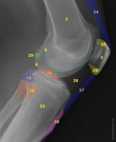 Normal Radiographic Anatomy Of The Knee Distal Femoral Metaphysis