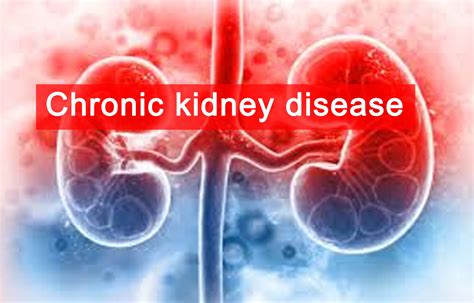 Chronic Kidney Disease Patients