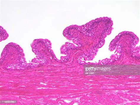 Transitional Epithelium Photos And Premium High Res Pictures Getty Images