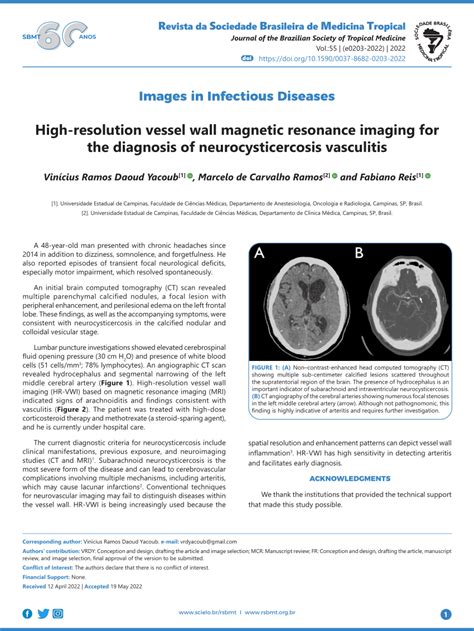 Pdf High Resolution Vessel Wall Magnetic Resonance Imaging For The
