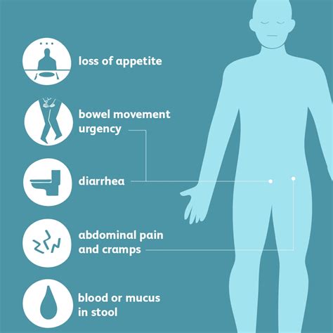 Ulcerative Colitis Symptoms Causes And Treatment Santripty