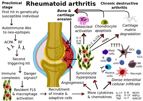 Overview Of Immunopathology In Rheumatoid Arthritis Scimeditor