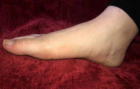 Calloused Crusty Cheesy Dirty Dry Feet And Rough Milf Soles 650 Pics