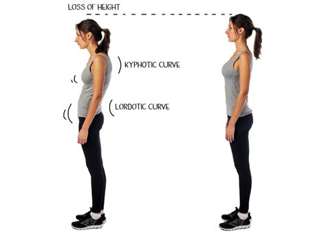 5 Benefits Of Improving Your Posture — Fitness Is Medicine