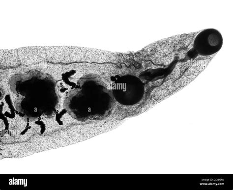 Parasitic Worm Microscope Black And White Stock Photos And Images Alamy