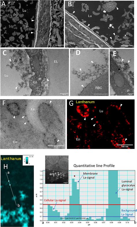 Morphology Of The Glycocalyx Under Physiological Conditions Imaged By