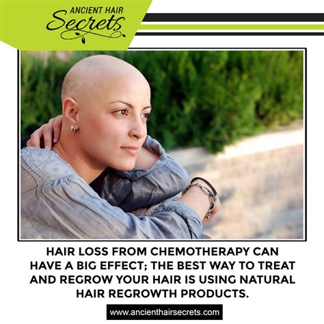Hair Loss From Chemotherapy Can Have A Big Effect The Best Way To