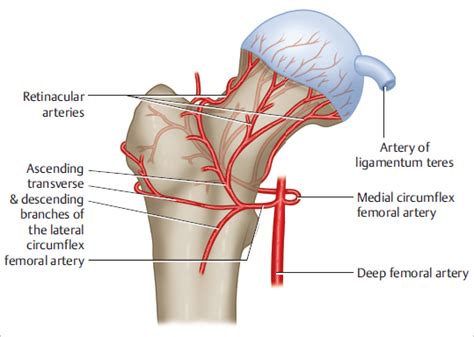 33 Femoral Neck And Head Fractures Musculoskeletal Key