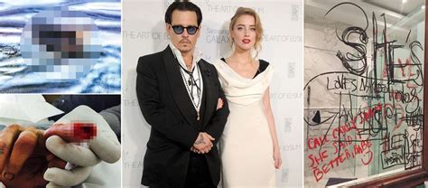 Inside Johnny Depp And Amber Heards Divorce From Severed Finger To Poo On Bed