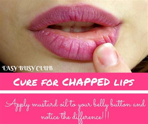 Care For Your Lips The Easy Way ‪‎skincare‬ ‪‎beauty