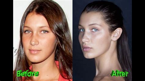 bella hadid before and after nose job plastic surgery youtube