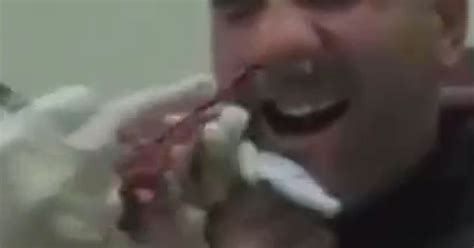 Is This The Longest Nose Tapeworm Ever Stomach Churning Video Shows Nurse Yanking Feet Long