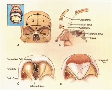 Foramen Magnum The Neurosurgical Atlas