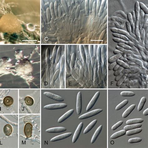 Colletotrichum Acutatum From Ex Epitype Strain Cbs 112996 Ab