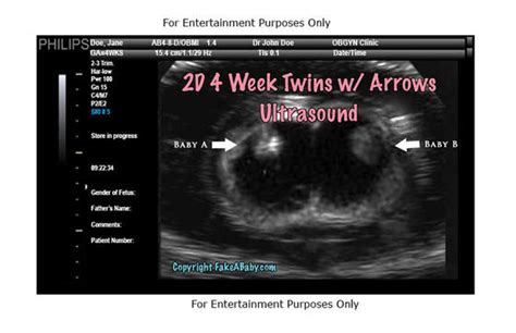 The 2d ultrasounds come in 3240 variations and the 3d ultrasounds come in 1920 variations. Cool Fake Ultrasound Versions - FakeaBaby.com