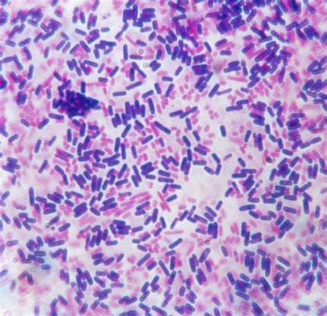What Gram Staining Is And How To Do It Microbiology Teaching Biology