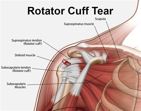 Rotator Cuff Anatomical Structure And Location Explanation Outline Diagram Stock Illustration