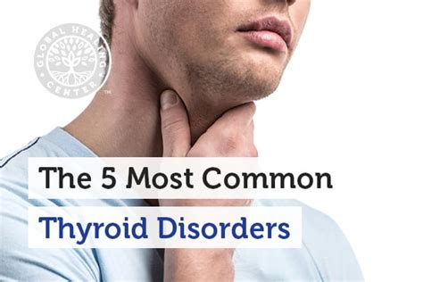 the 5 most common thyroid disorders