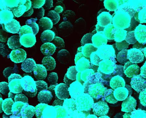 Staphylococcus Aureus Bacteria Photograph By Dr Kari Lounatmaa Science