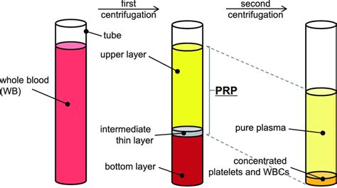 Two Step Process Of Centrifugal Separation Of The Whole Blood In A Tube