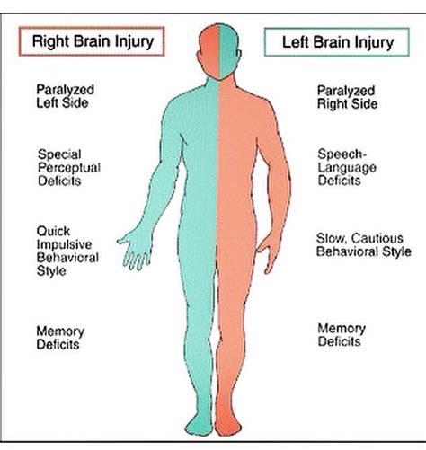 Right And Left Brain Injury And Sides Nurse Medical Knowledge
