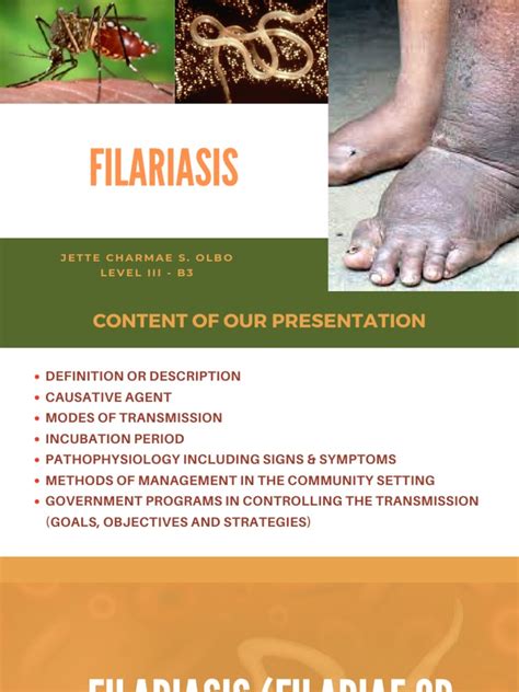 Filariasis Report Ncm 55 B3 Pdf Clinical Medicine Parasitology