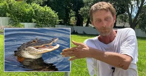 florida man whose arm is bitten off by alligator survives three days us news metro news