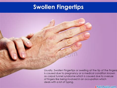 Swollen Fingertipswhat Can Cause Swelling At The Tip Of The Fingers