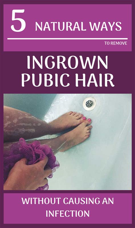Medication For Ingrown Pubic Hair How To Avoid And Treat Ingrown Pubic Hairs Janettedickierx