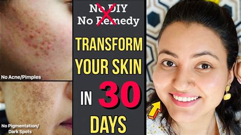 Transform Your Skin In 30 Days Follow These 9 Habits Diet Plan For