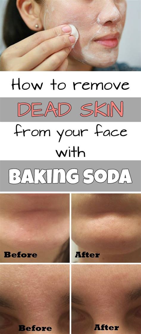 How To Remove Dead Skin From Your Face With Baking Soda All Remedies