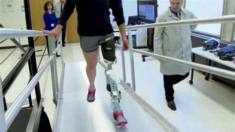 Scientists Develop A Bionic Leg Thats Controlled By Thoughts