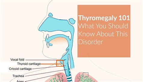 Thyromegaly 101 What You Should Know About This Disorder The Healthy