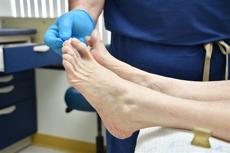 Bunion Surgery Recovery What To Expect And How To Prepare — Snug Safety