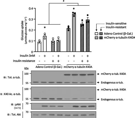 α Tubulin acetylation on lysine 40 controls cardiac glucose uptake