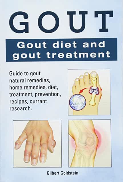Treatment For Gout