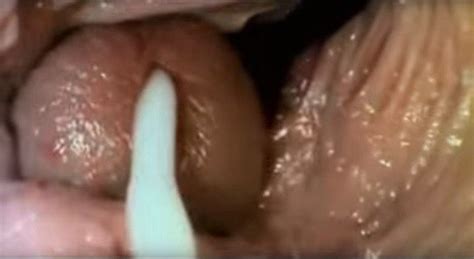 Vulva Ejaculation