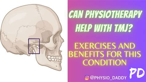 Can Physiotherapy Help With Tmj Exercises And Benefits For This Condition