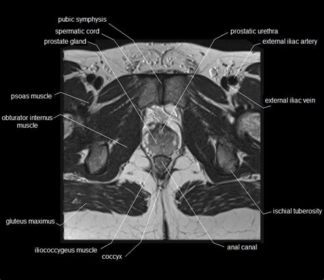 Mri Pelvis Anatomy Free Male Pelvis Axial Anatomy