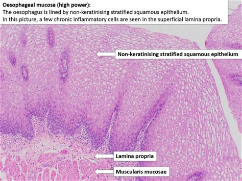 Oesophagus Normal Histology Nus Pathweb Nus Pathweb