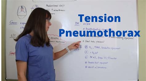 Tension Pneumothorax Youtube