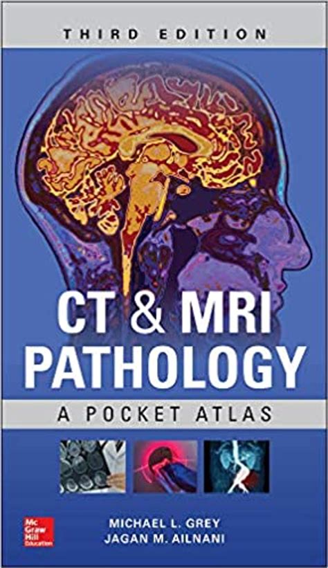 Ct And Mri Pathology A Pocket Atlas 3rd Edition By Michael L Grey In