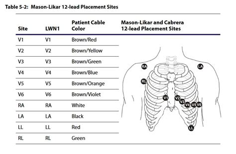 12 Lead Placement Guide With Diagram Video